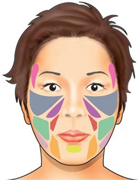 Sculptra - Facial area diagram